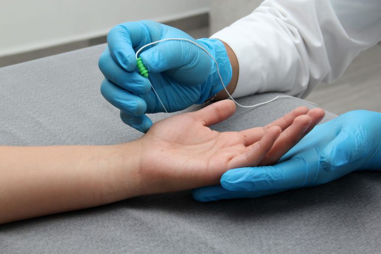 Understanding EMG NCV and NCS: What to Expect from Electromyography and Nerve Conduction Studies
