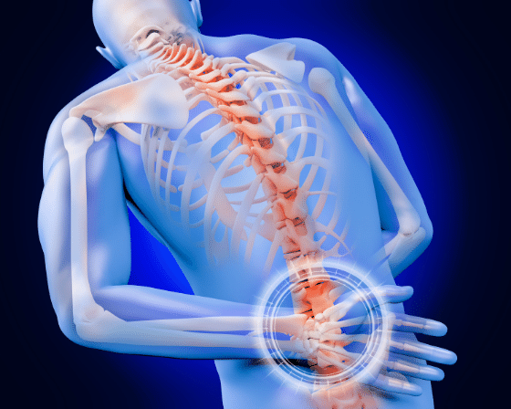 Quadratus Lumborum Syndrome