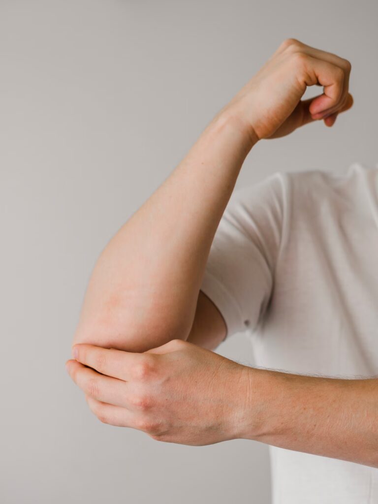 Cubital Tunnel Syndrome