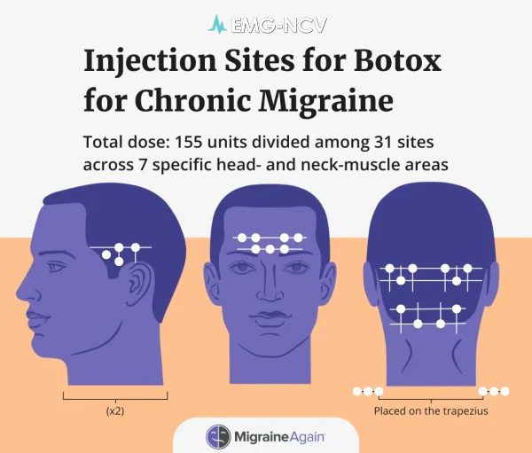botox